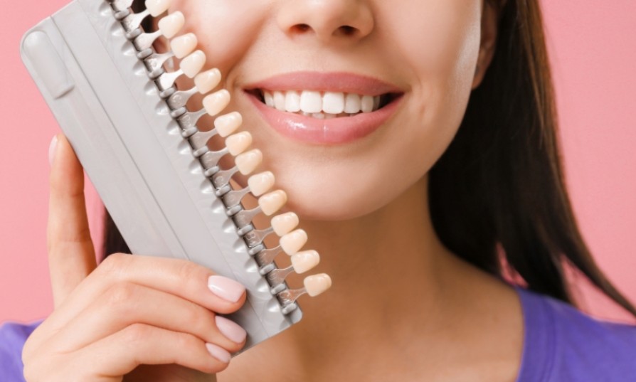5 Worst Habits for Veneered Teeth